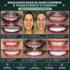NatureSmile™ SmileUltraFit - Facetas Dentárias Premium de Encaixe Natural