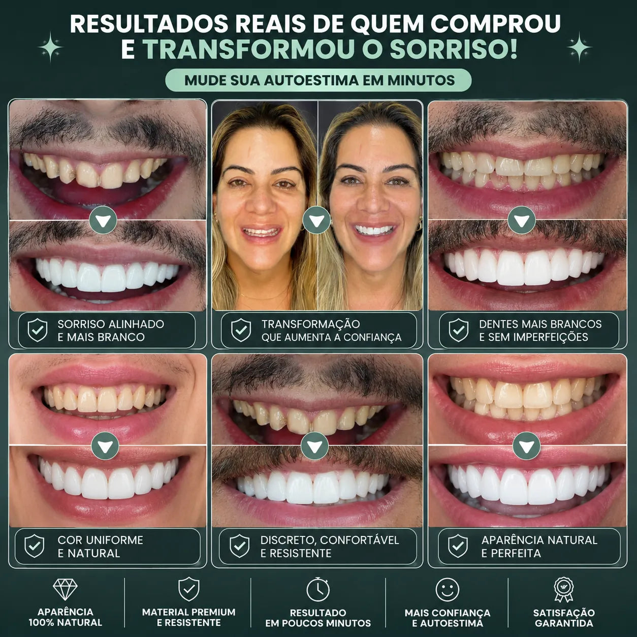 NatureSmile™ SmileUltraFit - Facetas Dentárias Premium de Encaixe Natural