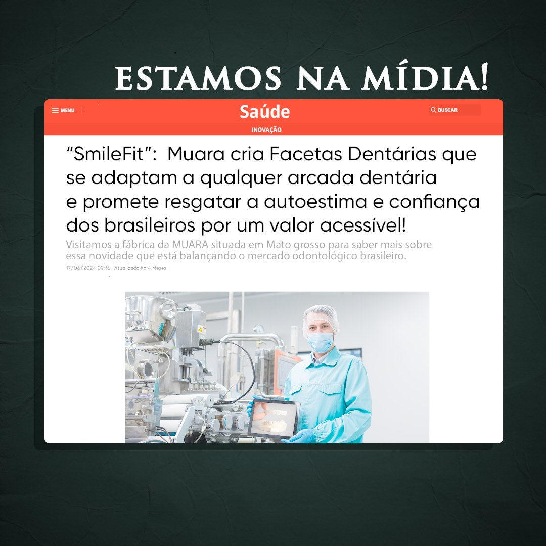 NatureSmile™ SmileUltraFit - Facetas Dentárias Premium de Encaixe Natural